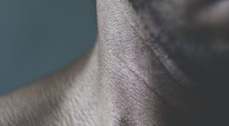 7 consejos para una piel atópica