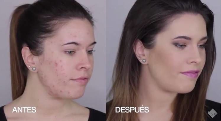 El antes y después del maquillaje corrector para pieles con acné