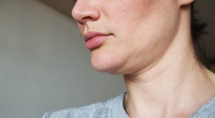 ¿Cómo combatir la flacidez facial?