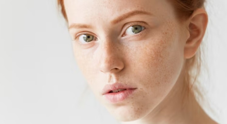 Manchas en la cara: Tipos y causas