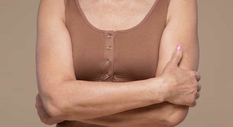 Arrugas en el escote: ¿Cómo evitarlas y tratarlas?