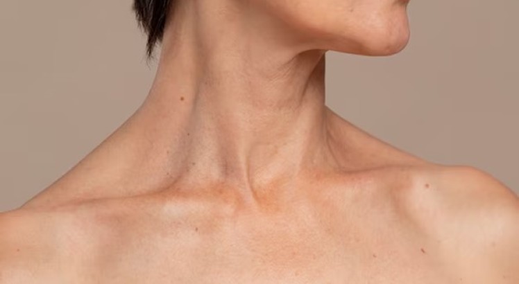 Manchas en el cuello: ¿Por qué aparecen?