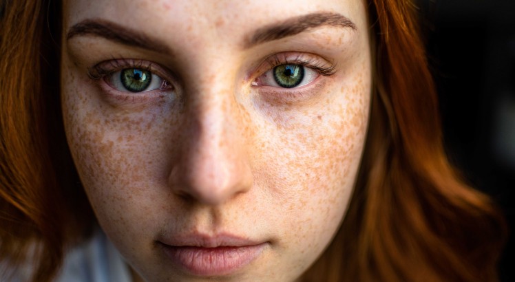 ¿Qué es el lifting facial?