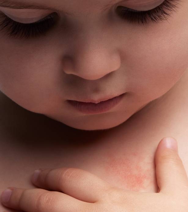 Conoce Cicaplast Baume B5+ de La Roche-Posay