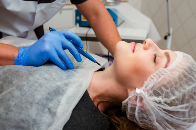 Por qué salen verrugas en el cuello